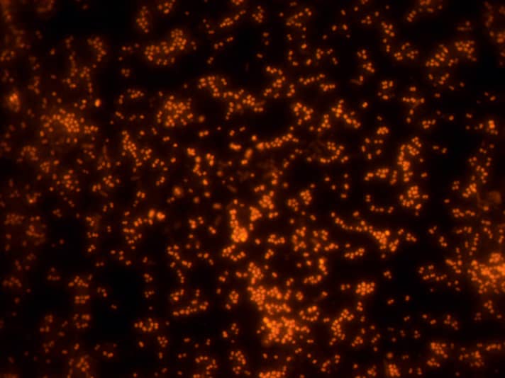 Als kleine stadjes in een nachtzicht op de aarde vanuit de ruimte, gloeien de bacteriën onder de microscoop. Dit wordt mogelijk gemaakt door een unieke methode om kleurmoleculen in de cellen te introduceren.
