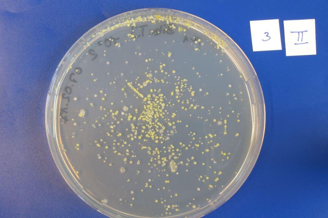 Een voedingsbodem wordt aangebracht op zogenaamde agarplaten. De bacteriën voeden zich hiermee en groeien vervolgens in kolonies (gele stippen).
